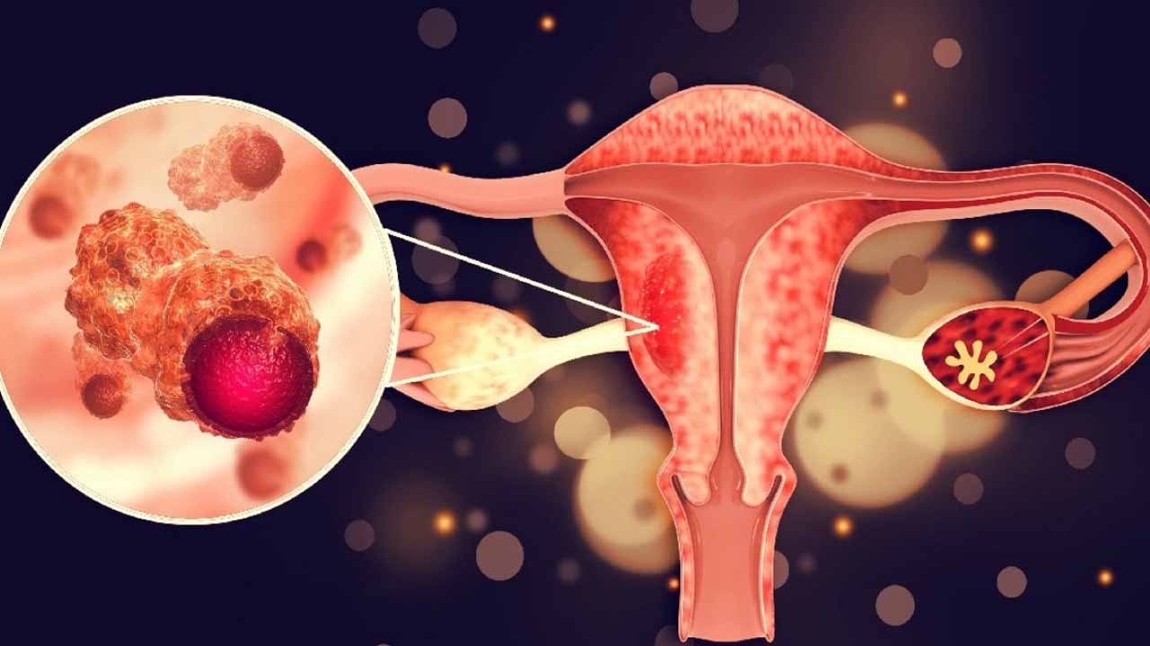 Relación Virus del Papiloma Humano (HPV) y Cancer